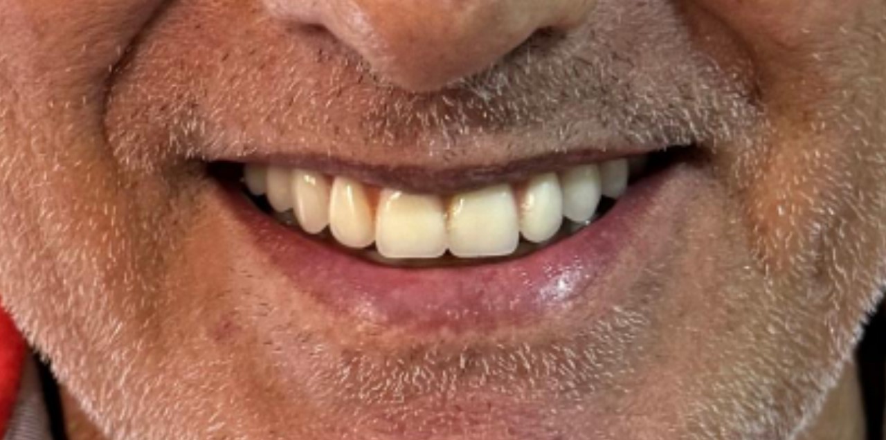 Imagem do WhatsApp de 2025-03-12 à(s) 11.14.15_fa70118f